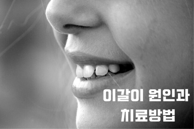 이갈이 원인과 치료방법